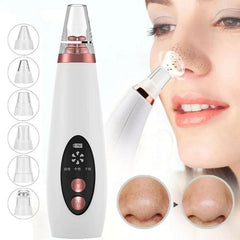 Blackhead Pore Remover Vacuum, Pore Cleaner. Microdermabrasion Kit